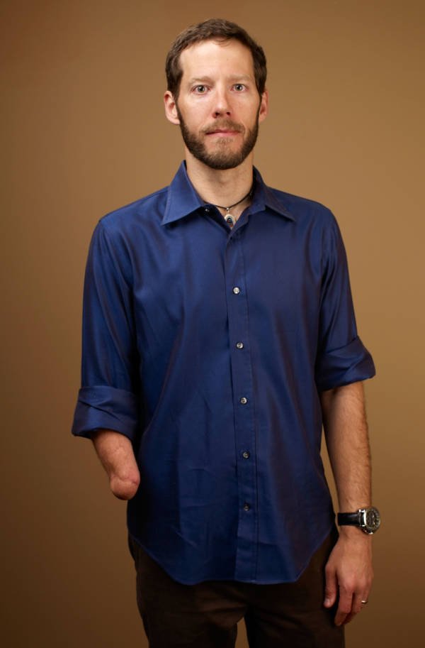 ralston-no-prosthetic